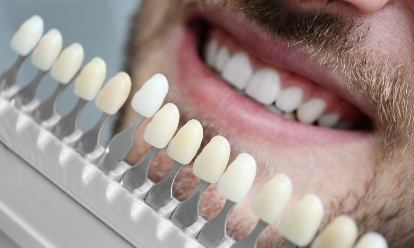 Dental Services in Richmond Hill